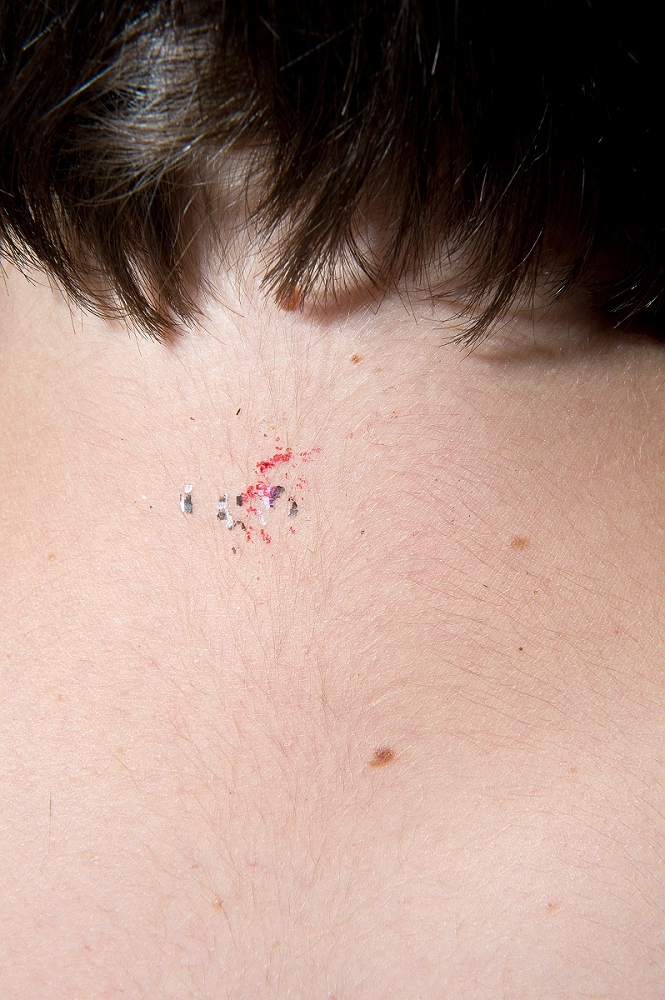 Petites mutilations quotidiennes / tattoo 07-2015 # 02 © frédéric iovino 2013