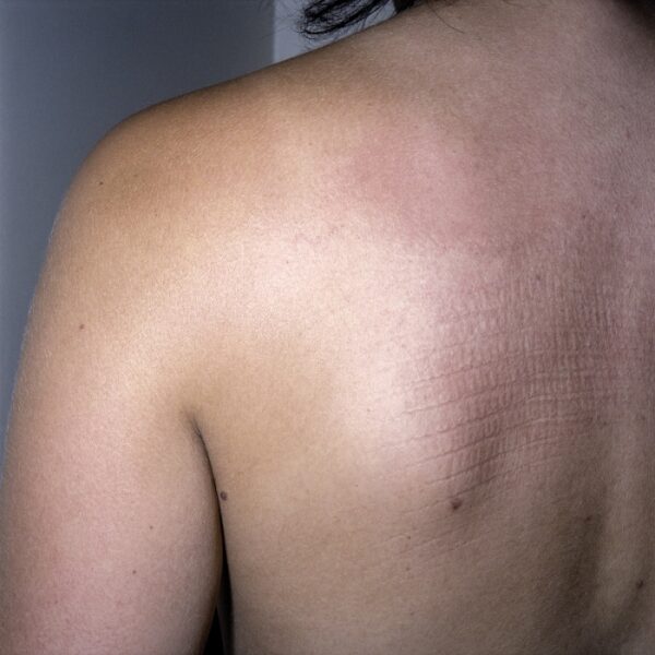 petites mutilations quotidiennes © frédéric iovino