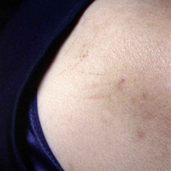 petites mutilations quotidiennes © frédéric iovino