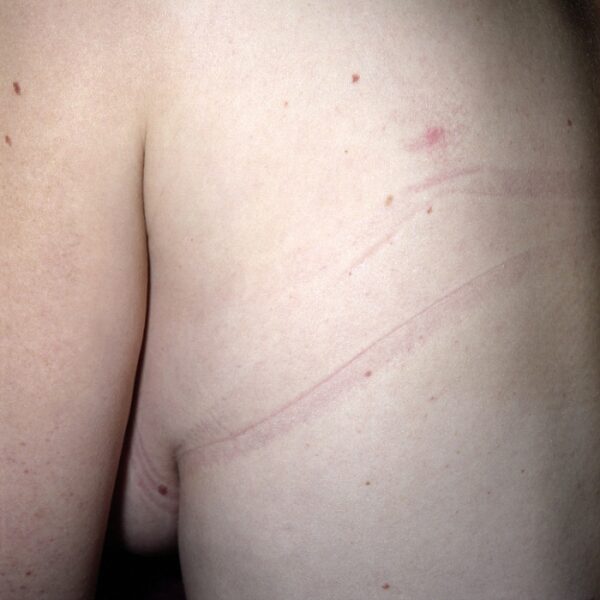 petites mutilations quotidiennes © frédéric iovino