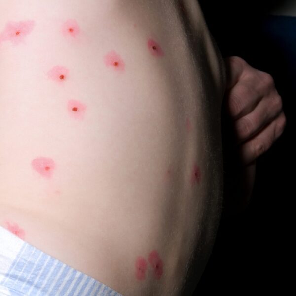 petites mutilations quotidiennes © frédéric iovino