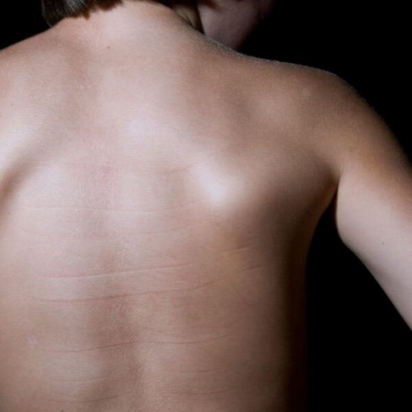 petites mutilations quotidiennes © frédéric iovino