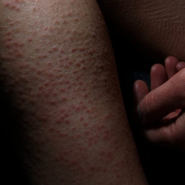 petites mutilations quotidiennes © frédéric iovino