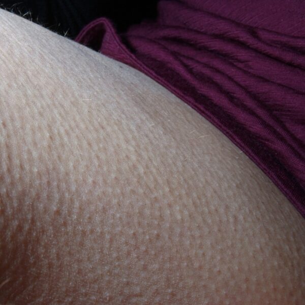 petites mutilations quotidiennes © frédéric iovino