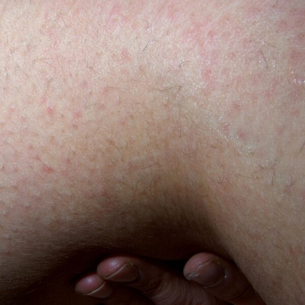 petites mutilations quotidiennes © frédéric iovino