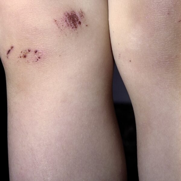 petites mutilations quotidiennes © frédéric iovino